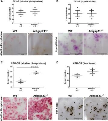 Arhgap21 Deficiency Results in Increase of Osteoblastic Lineage Cells in the Murine Bone Marrow Microenvironment